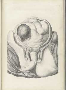 arm reaching out