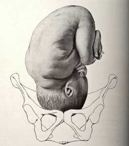 through the pelvis
